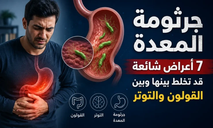 جرثومة المعدة: 7 أعراض شائعة قد تخلط بينها وبين القولون والتوتر